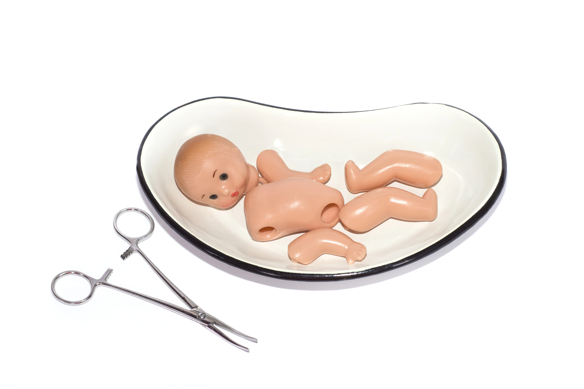 abortion